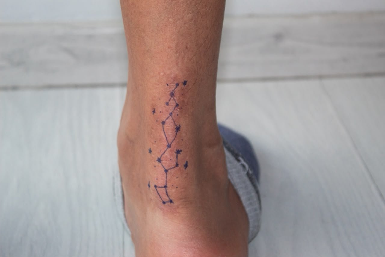 Photographic study of a scar and constellation intervention