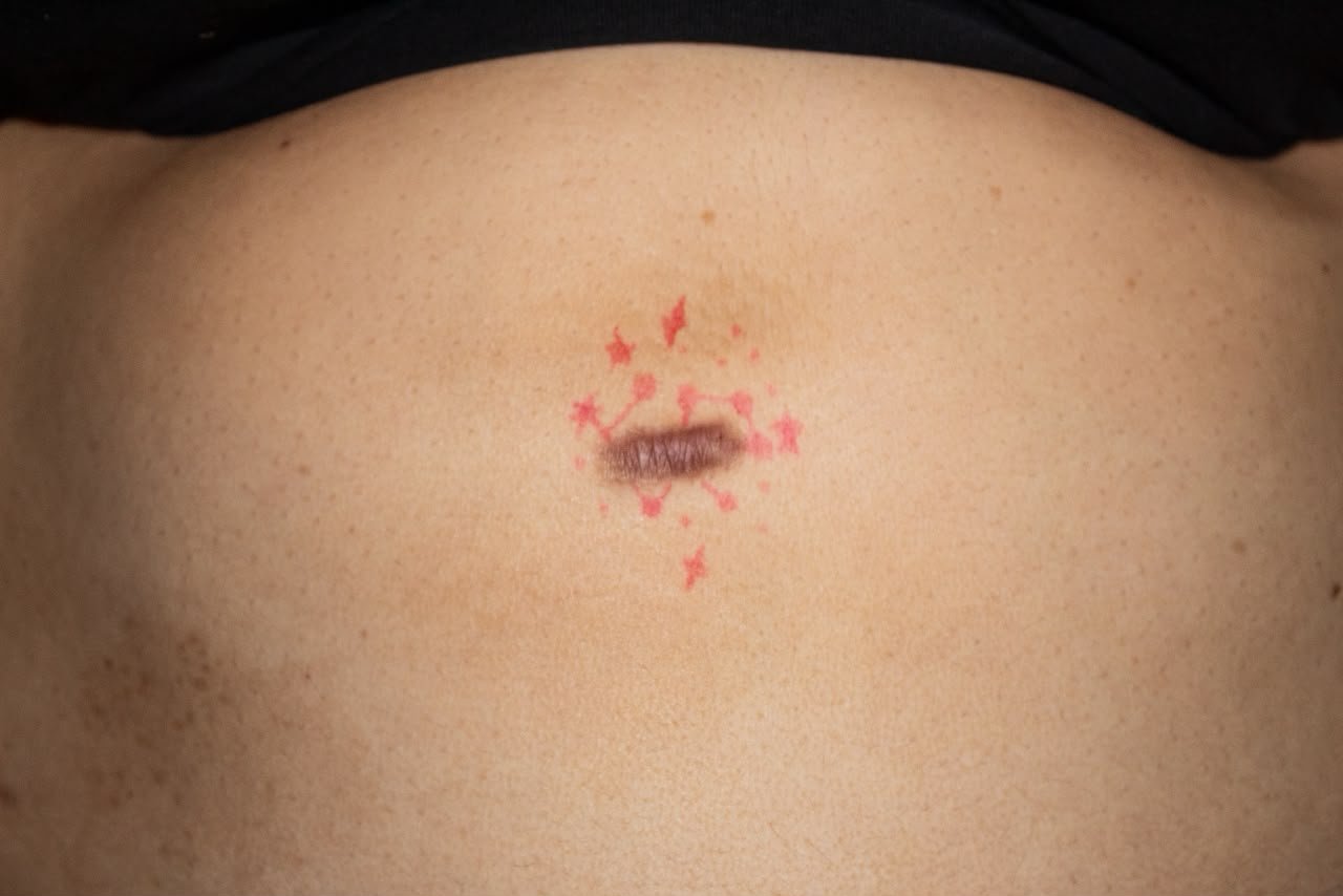Skin and constellation intervention