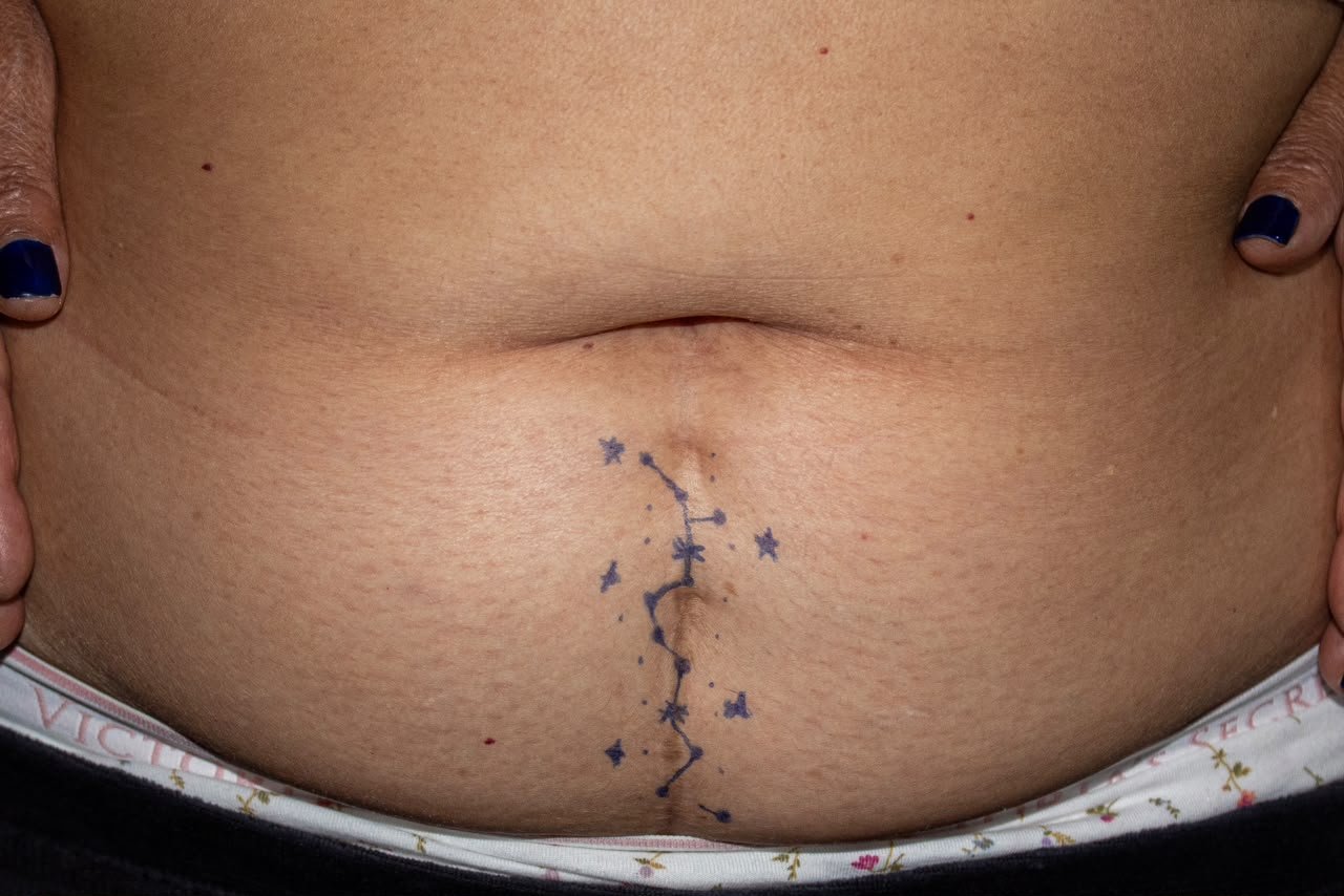 Photographic documentation of a scar